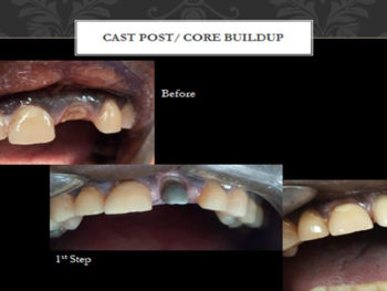 cast-post-crow