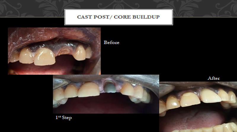 cast-post-crow